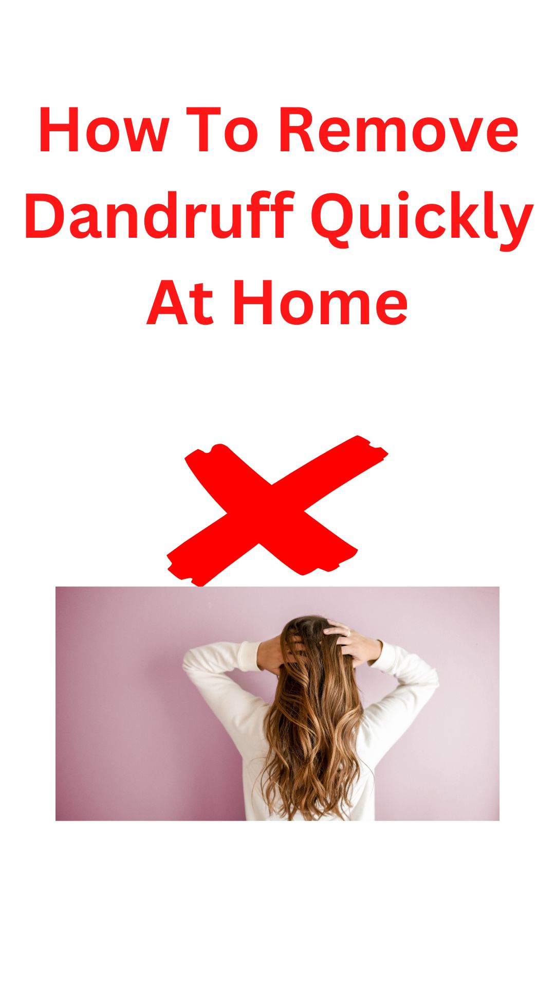 How To Remove Dandruff Quickly At Home